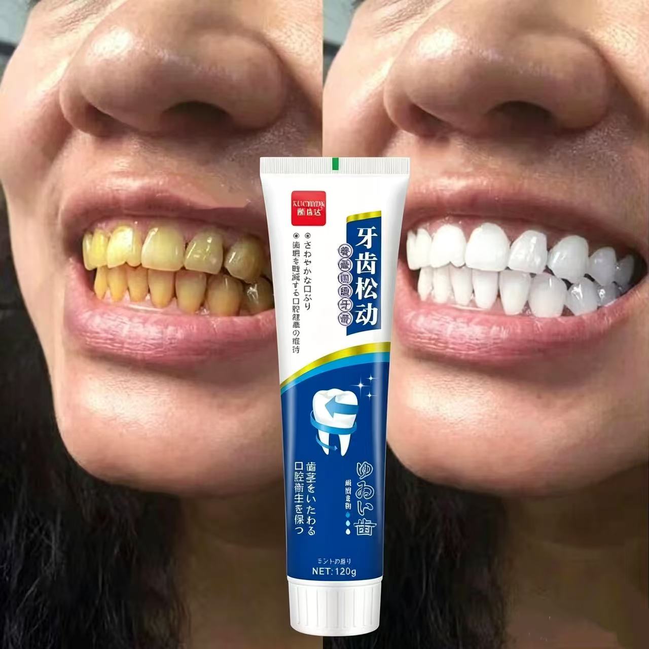 Teeth Whitening Japanese - 느슨한 치아를 고치는 일본 수입 치약,