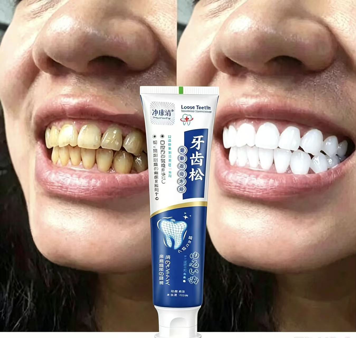 Teeth Whitening Japanese - 느슨한 치아를 고치는 일본 수입 치약,