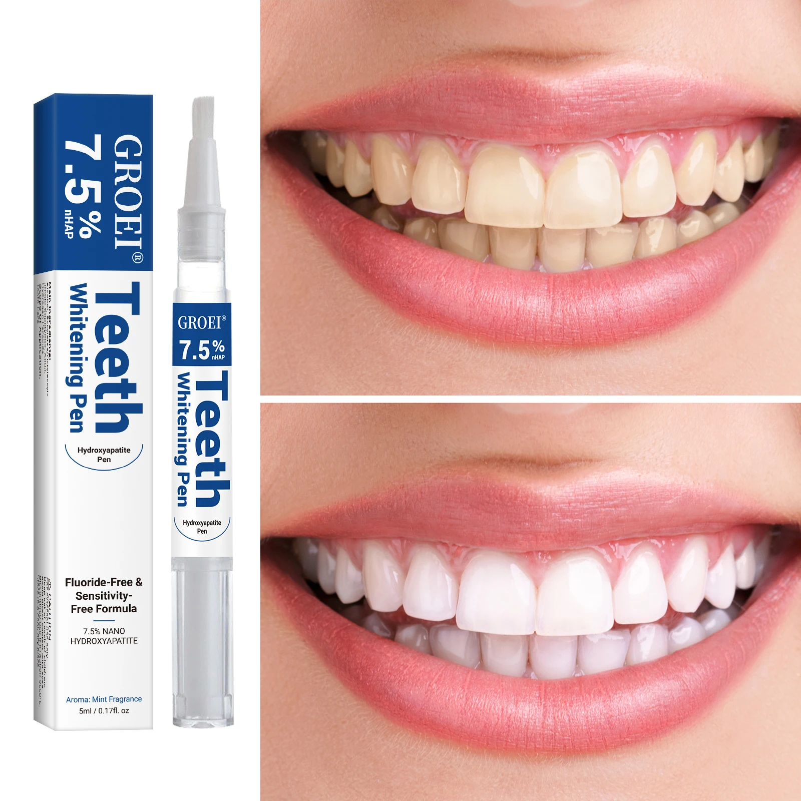 하이드록시아파타이트 치아 미백 펜 눈부신 화이트 얼룩  - Teeth Whitening Remedies 리뷰 및 가격