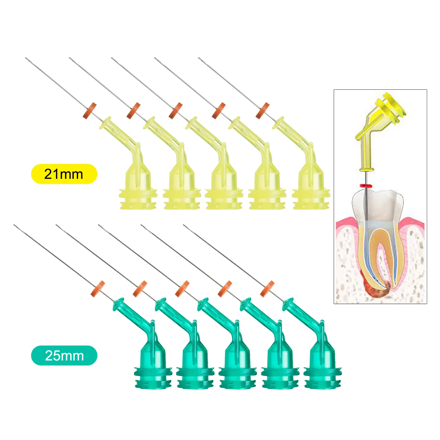 JOLANT 치과 관개 엔도 바늘 팁, 근관 주사기,  - Teeth Whitening Tips 리뷰 및 가격
