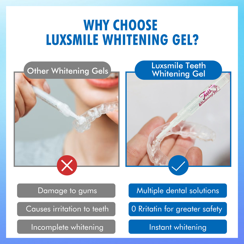 치아 미백 젤 PAP 또는 35%CP 치아 미백 젤 구 - Teeth Whitening Bleaching Kit 리뷰 및 가격