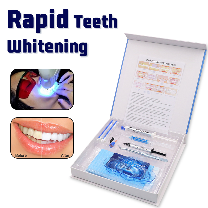 전문 치아 표백 키트 치과 미백 젤 과산화물 치아 미백 - Teeth Whitening Bleaching Kit 리뷰 및 가격