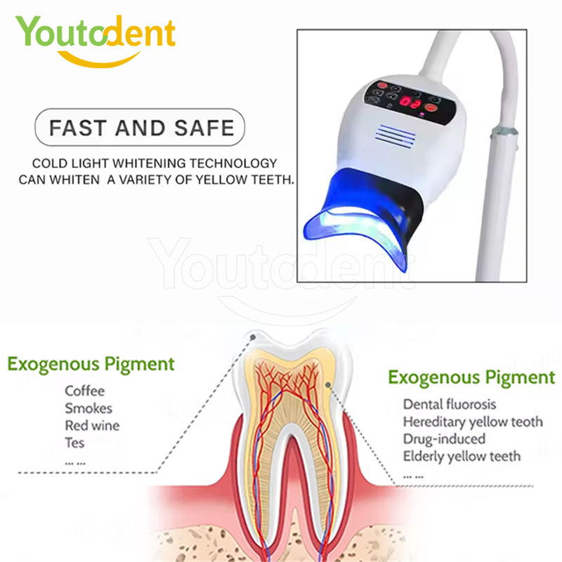 전문 치과용 3색 광 램프 치아 미백기 미백 촉진 장치 - Teeth Whitening Light 리뷰 및 가격