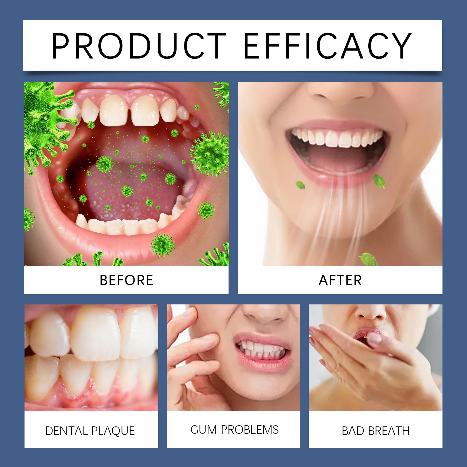 코코넛 오일 풀링 마우스워시 (민트 혀클리너 포함) 무 - Teeth Whitening Oil Pulling 리뷰 및 가격