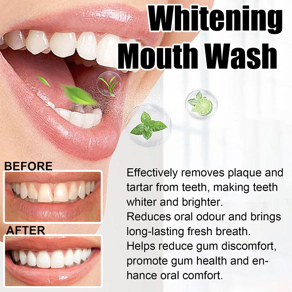 코코넛 민트 풀링 오일 구강청결제 무알코올 구강 치아  - Teeth Whitening Oil Pulling 리뷰 및 가격