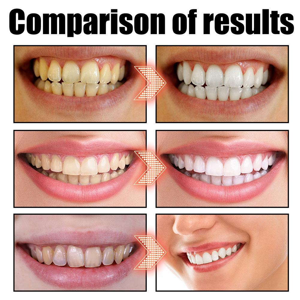 코코넛 민트 풀링 오일 구강청결제 무알코올 구강 치아  - Teeth Whitening Oil Pulling 리뷰 및 가격