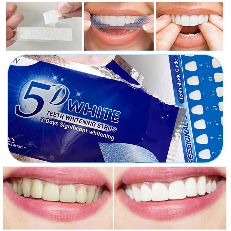 1/7/14pair 치아 미백 스트립 치아 미백 키트  - Teeth Whitening Bleaching Kit 리뷰 및 가격
