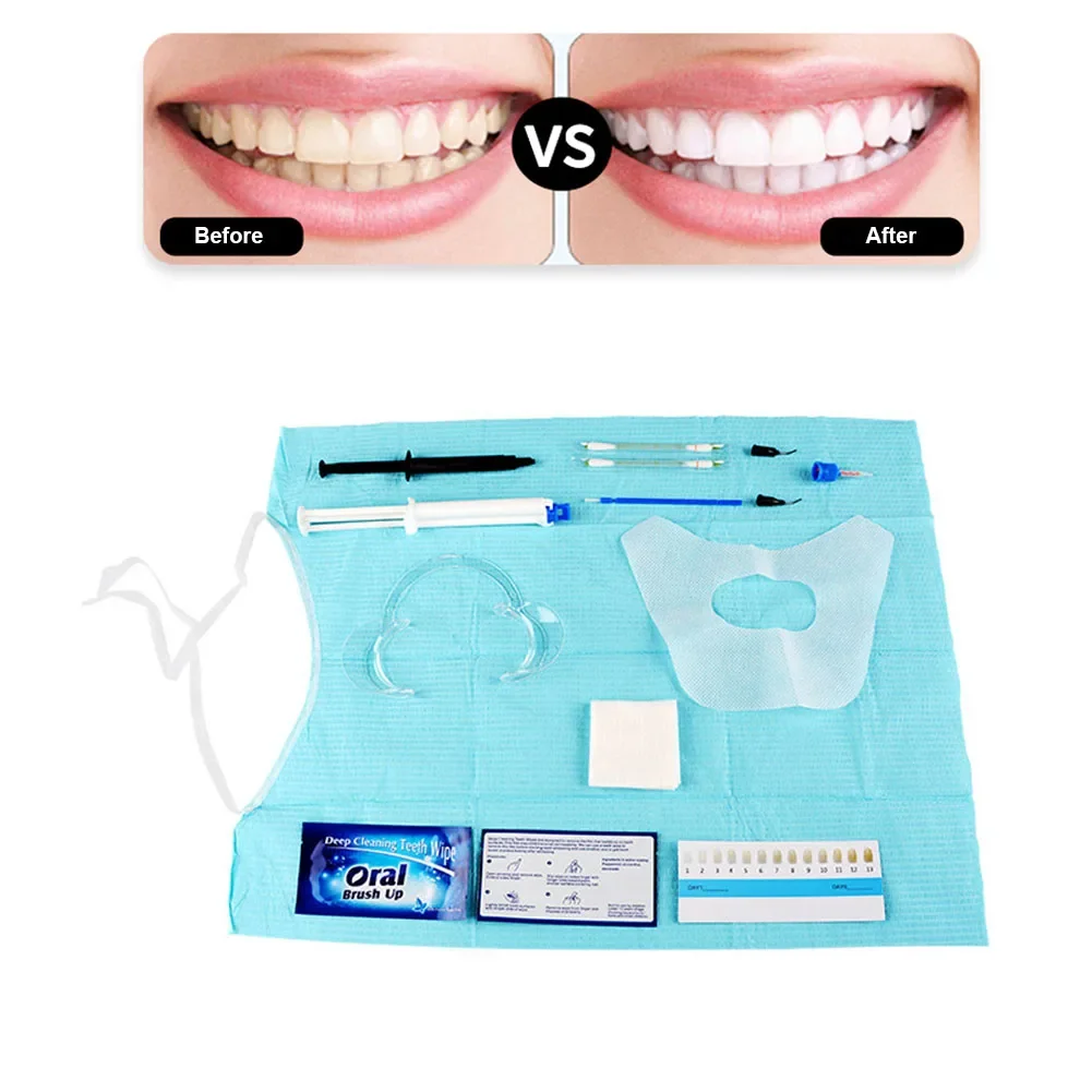 치과의사 클리닉 치아 미백 키트, 35% HP 이중 배 - Teeth Whitening Bleaching Kit 리뷰 및 가격