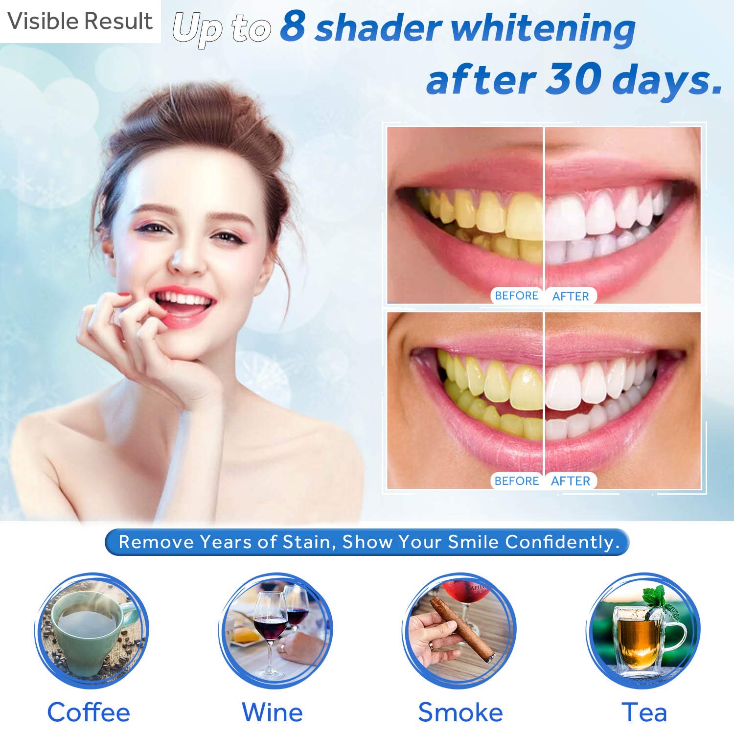 치아 미백 젤 리필 주사기 치아 미백 젤 인비스알라인  - Teeth Whitening Remedies 리뷰 및 가격