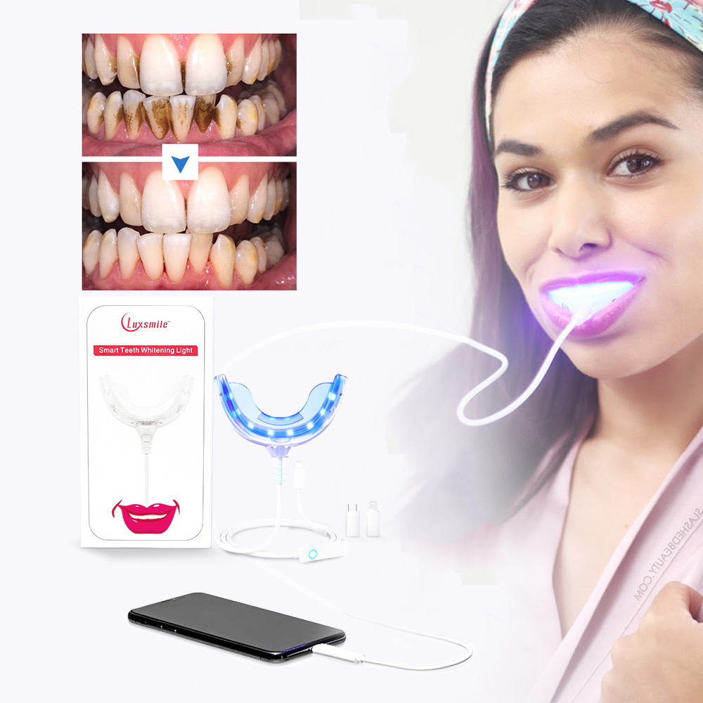 Luxsmile 스마트 LED 치아 미백 휴대용 USB - Teeth Whitening With Blue Light 리뷰 및 가격