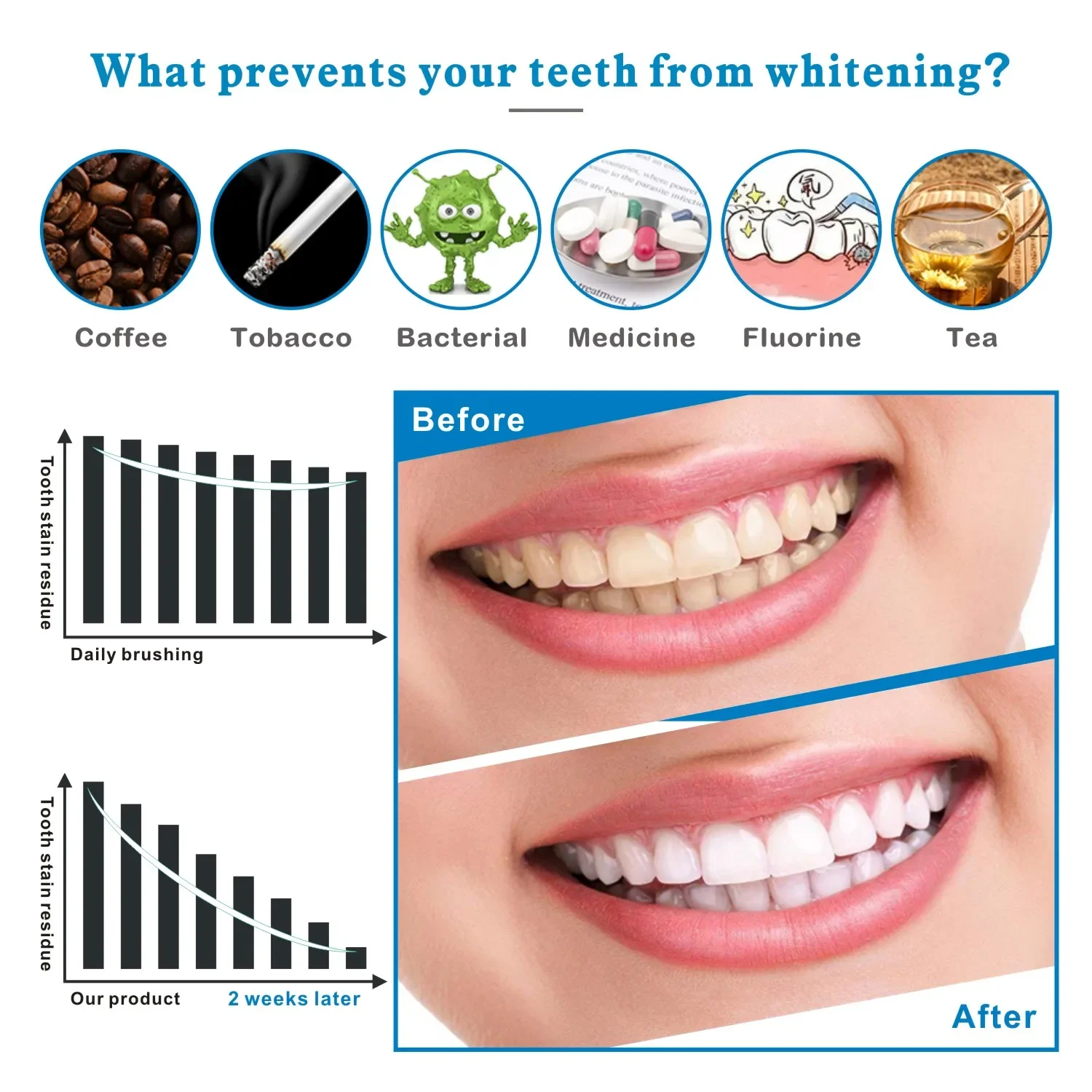 14/28pcs 3D 치아 미백 스트립 Whit 전문  - Whitening Strip 3D 리뷰 및 가격