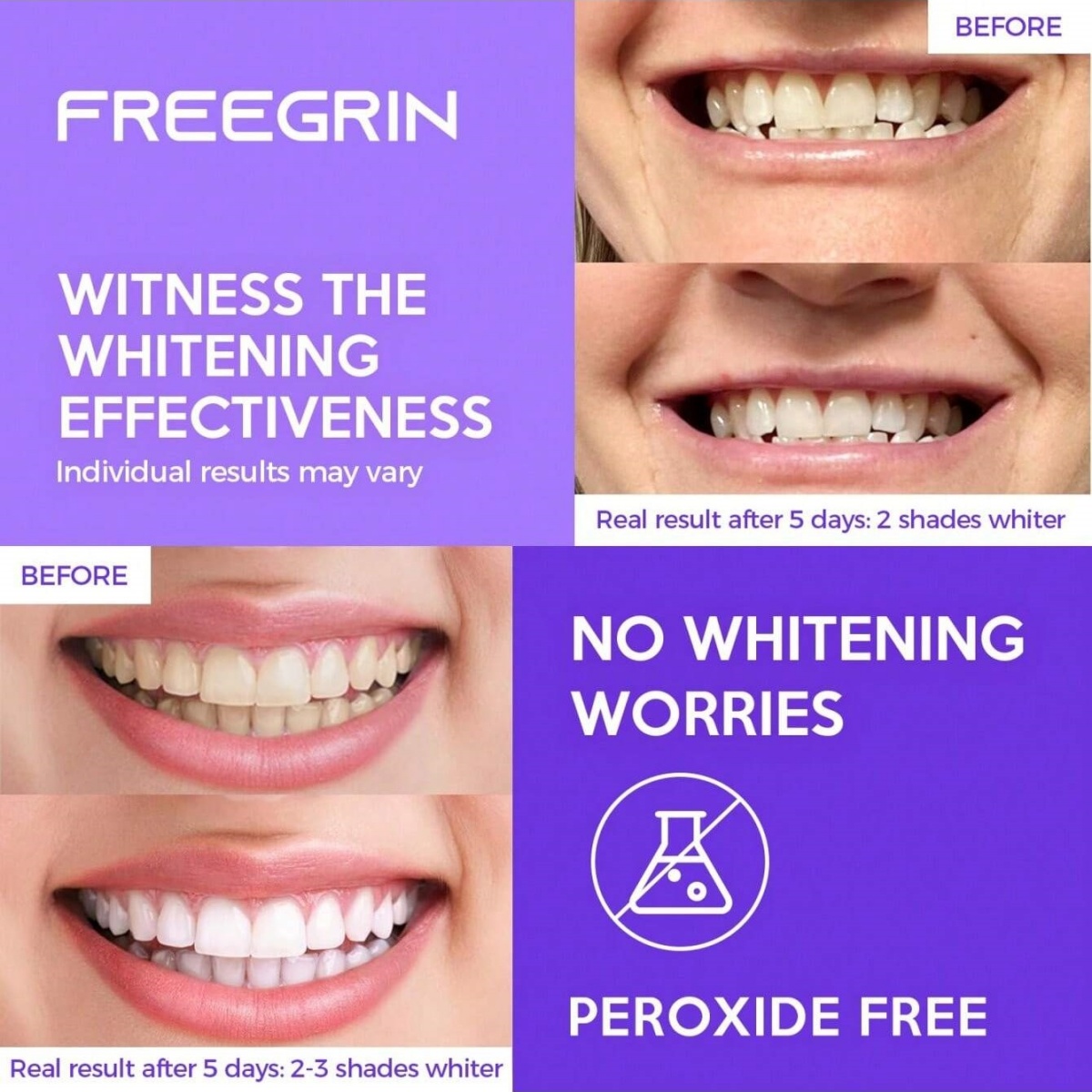 디럭스 화이트닝 치아 스티커 7/14/21 쌍 젤 화이 - Teeth Whitening Remedies 리뷰 및 가격