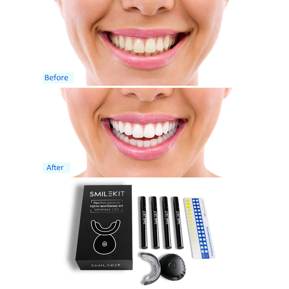 전기 치아 미백 LED 가정용 무선 치아 표백 젤 키트 - Teeth Whitening Bleaching Kit 리뷰 및 가격