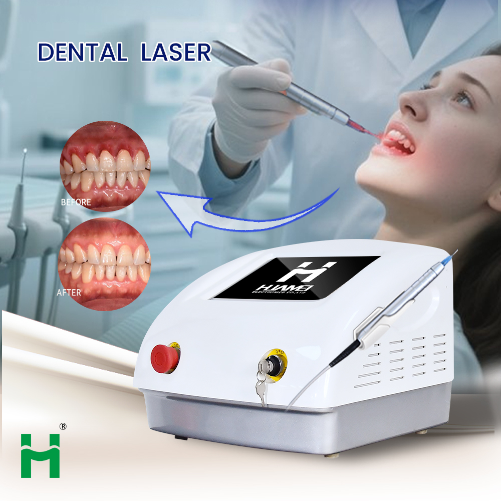 휴대용 LED 치아 미백 키트: 15-30W 조절 가능 - Teeth Whitening Bleaching Kit 리뷰 및 가격