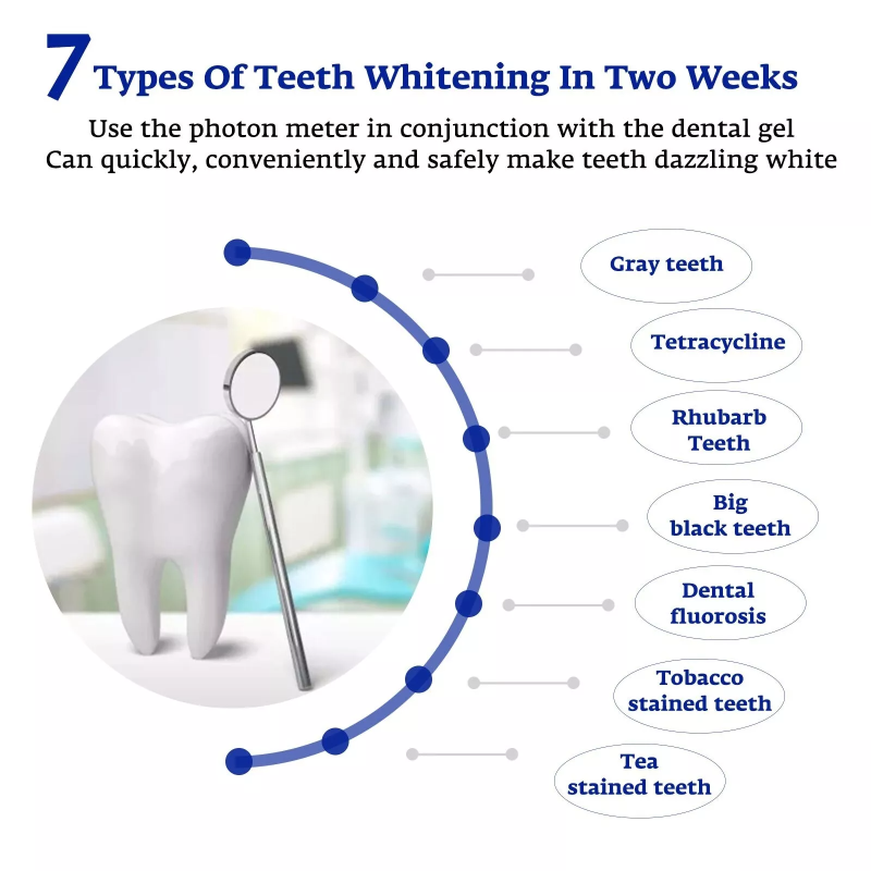 치아 미백 가속기 스마트 LED 블루 라이트 휴대용 U - Teeth Whitening With Blue Light 리뷰 및 가격