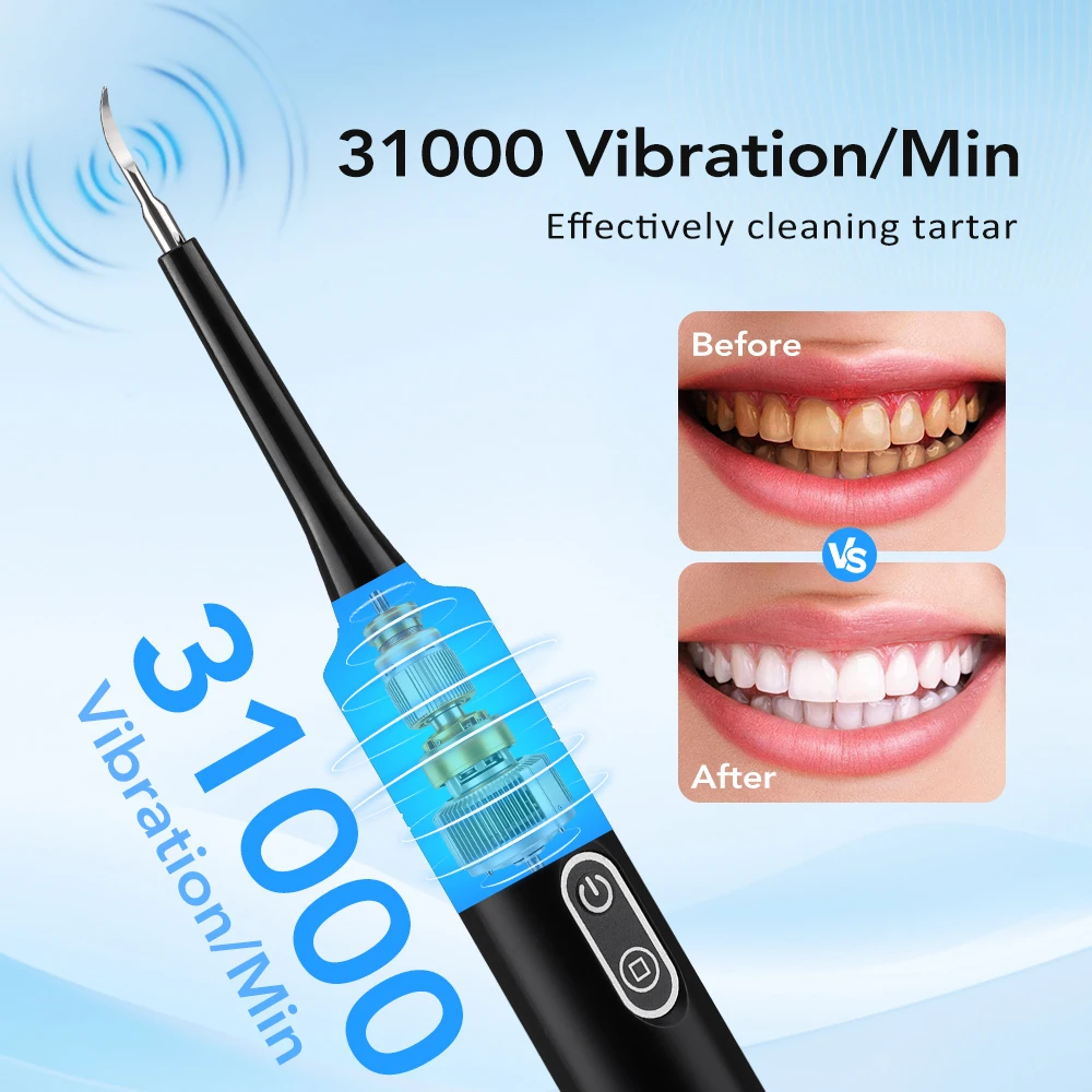 전동 음파 진동 치석 제거기 치아 미백 플라그 제거 치 - Teeth Whitening Toothbrush 리뷰 및 가격